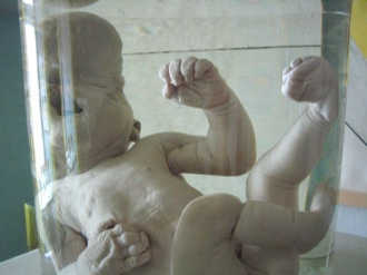 1213880351 anotomy12